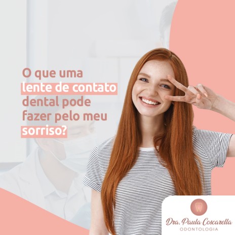 O que uma lente de contato dental pode fazer pelo meu sorriso?