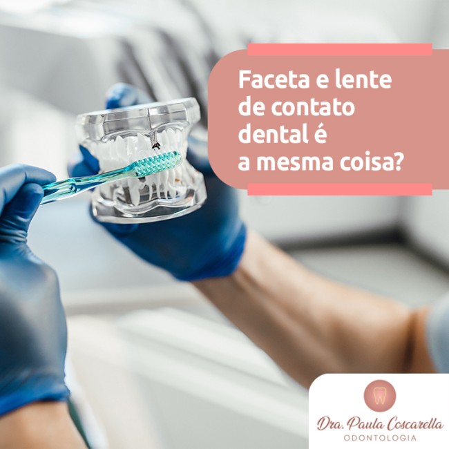 Faceta e lente de contato dental é a mesma coisa?
