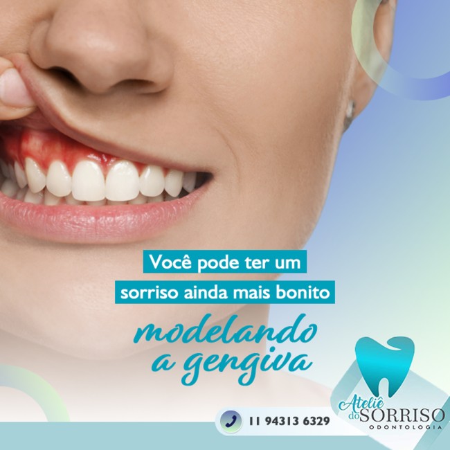 Você pode ter um sorriso ainda mais bonito modelando a gengiva