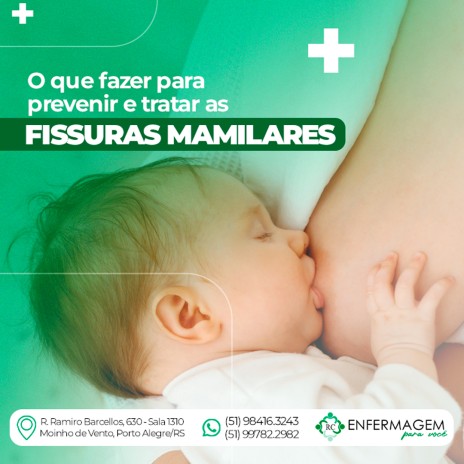 O que fazer para prevenir e tratar as fissuras mamilares