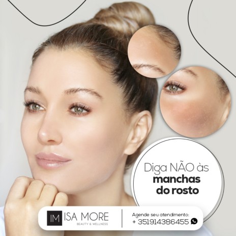 Diga NÃO às manchas do rosto.