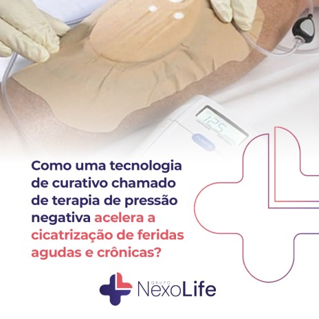 Como uma tecnologia de curativo chamado de terapia de pressão negativa acelera a cicatrização de feridas agudas e crônicas?