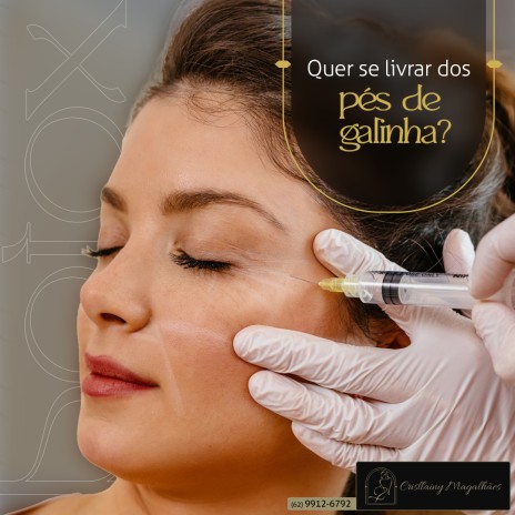 Quer se livrar dos pés de galinha?