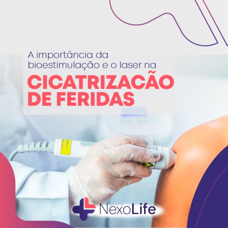 A importância da bioestimulação e o laser na cicatrização de feridas