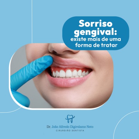 Sorriso gengival: existe mais de uma forma de tratar