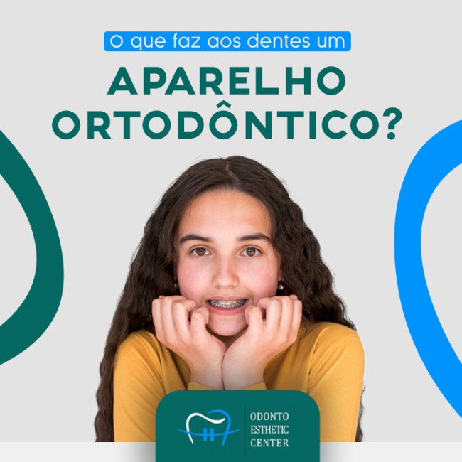 O que faz aos dentes um aparelho ortodôntico?