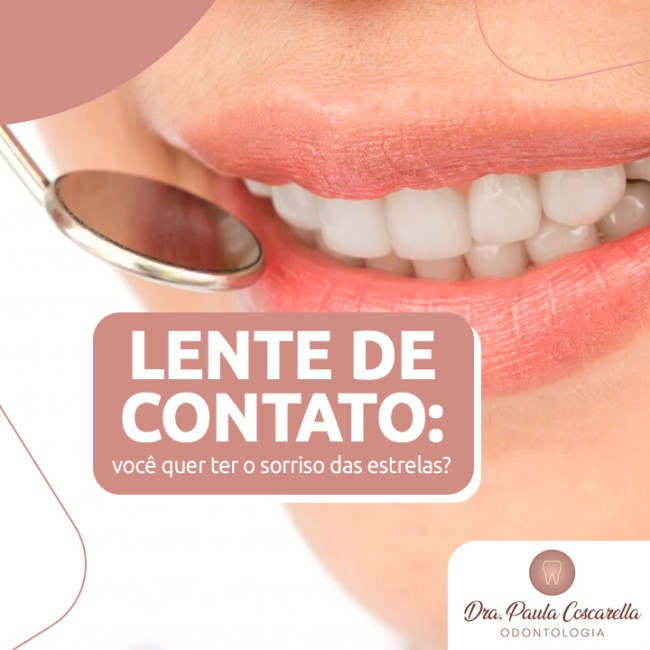 Lente de contato: você quer ter o sorriso das estrelas?