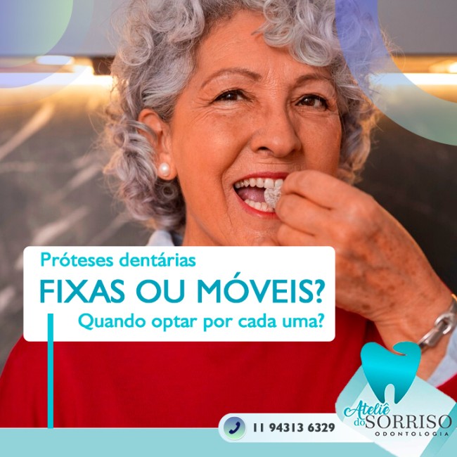 Próteses dentárias fixas ou móveis? Quando optar por cada uma?