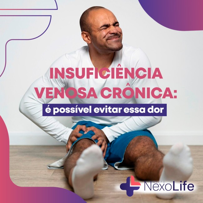 Insuficiência venosa crônica: é possível evitar essa dor