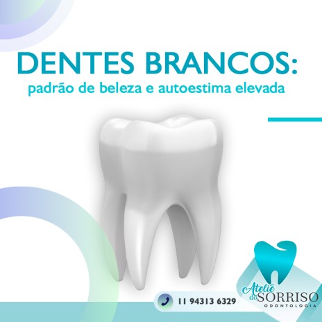Dentes brancos: padrão de beleza e autoestima elevada