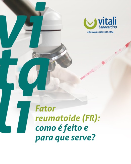 Fator reumatoide (FR): como é feito e para que serve?