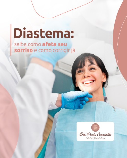 Diastema: saiba como afeta seu sorriso e como corrigir já