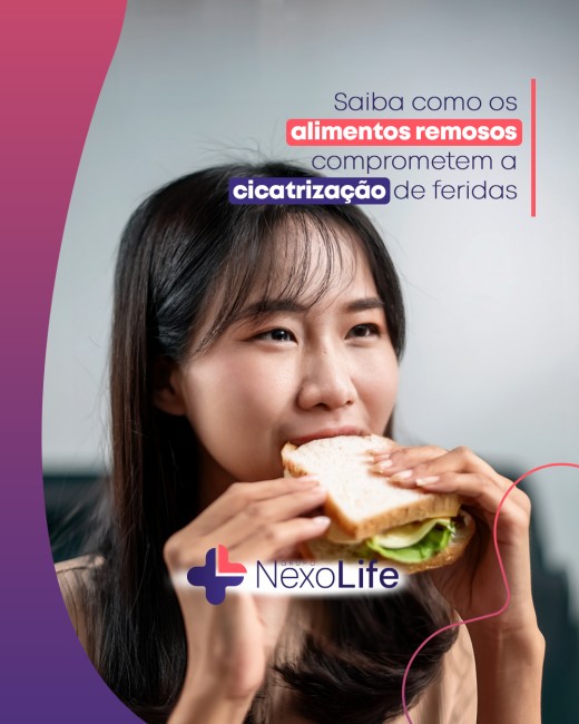 Saiba como os alimentos remosos comprometem a cicatrização de feridas