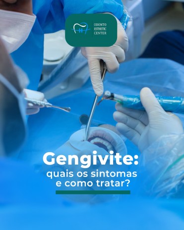 Gengivite: quais os sintomas e como tratar?