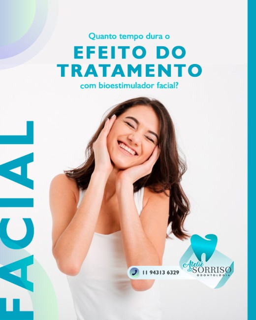 Quanto tempo dura o efeito do tratamento com bioestimulador facial?