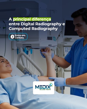 A principal diferença entre Digital Radiography e Computed Radiography