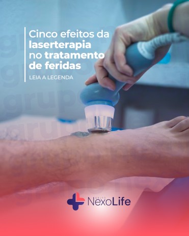 Cinco efeitos da laserterapia no tratamento de feridas