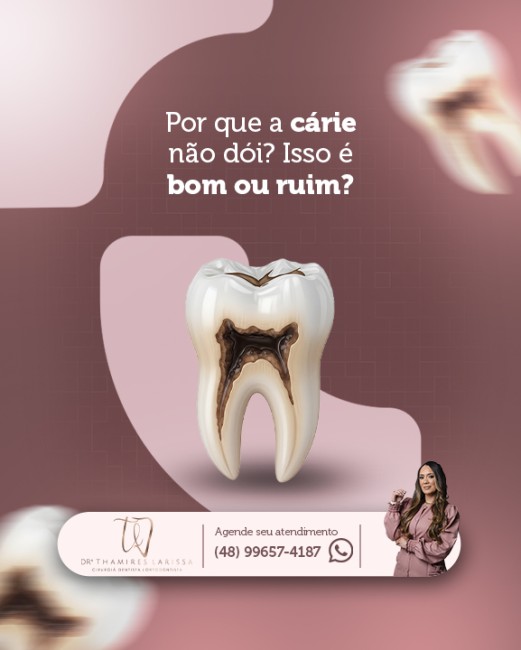 Por que a cárie não dói? Isso é bom ou ruim?