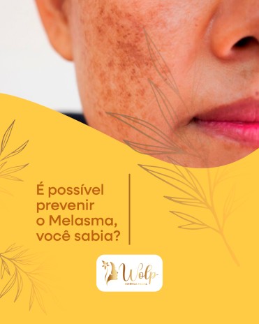 É possível prevenir o Melasma, você sabia?