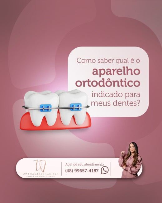 Como saber qual é o aparelho indicado para meus dentes?