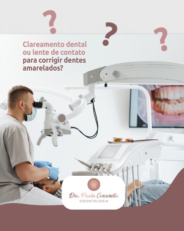 Clareamento dental ou lente de contato para corrigir dentes amarelados?