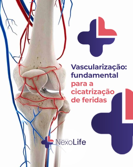 Vascularização: fundamental para a cicatrização de feridas