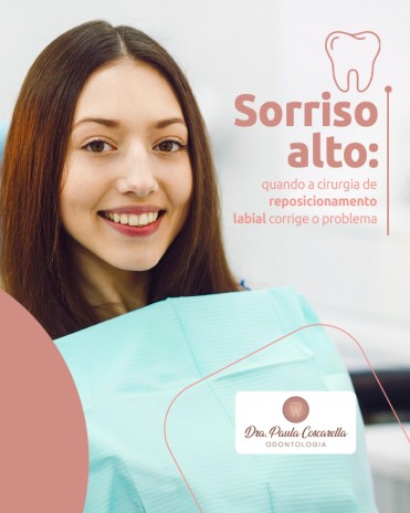 Sorriso alto: quando a cirurgia de reposicionamento labial corrige o problema