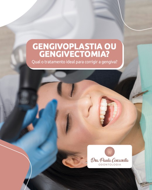 Gengivoplastia ou gengivectomia? Qual o tratamento ideal para corrigir a gengiva?