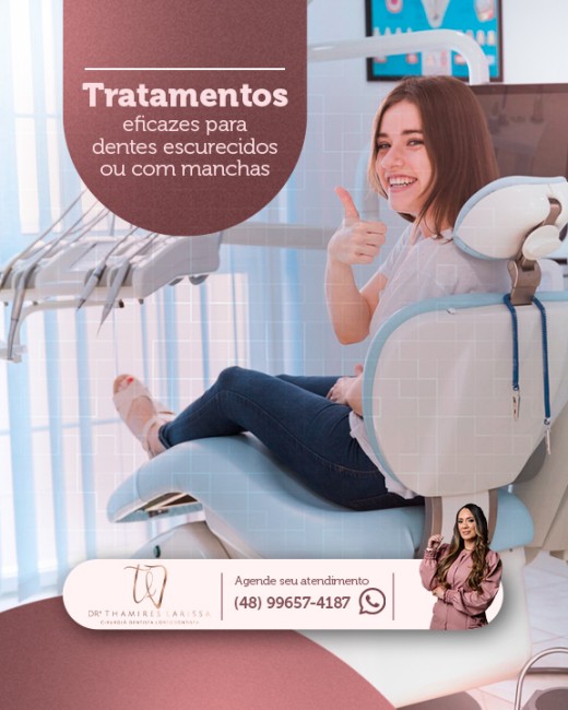 Tratamentos eficazes para dentes escurecidos ou com mancha