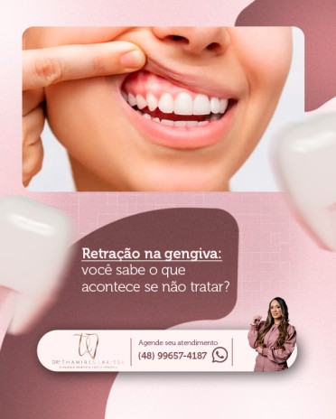 Retração na gengiva: você sabe o que acontece se não tratar?