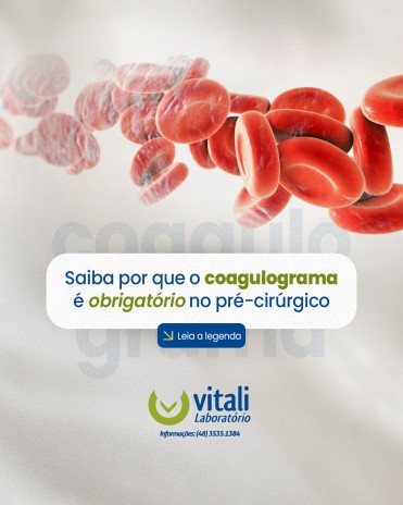 Saiba por que o coagulograma é obrigatório no pré-cirúrgico