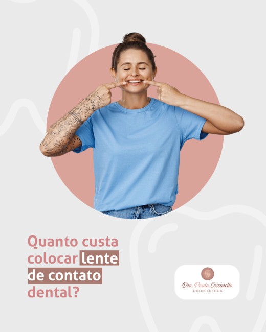 Quanto custa colocar lente de contato dental?