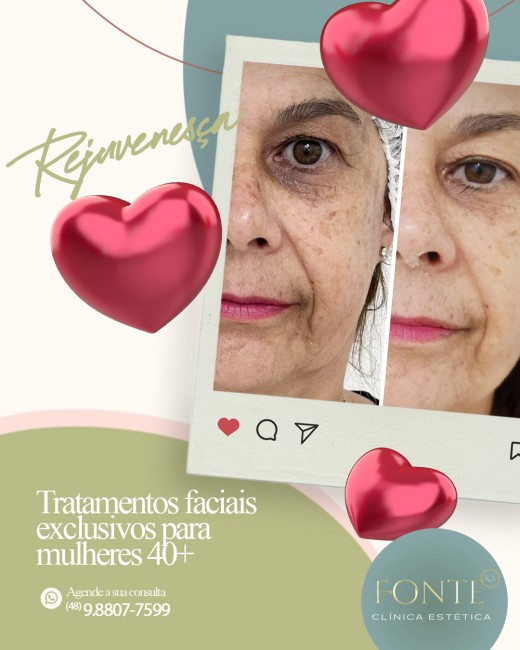 Existe um tratamento profissional prioritário se você quer cuidar da beleza do seu rosto