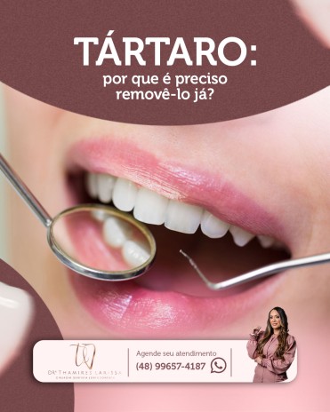 Tártaro: por que é preciso removê-lo já?