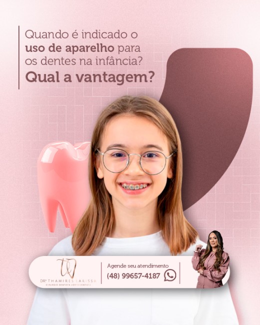 Quando é indicado o uso de aparelho para os dentes na infância? Qual a vantagem?