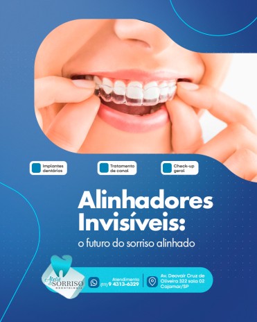 Alinhadores Invisíveis: o futuro do sorriso alinhado