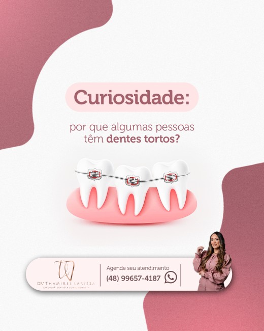 Curiosidade: por que algumas pessoas têm dentes tortos?