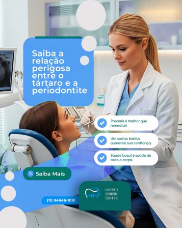 Saiba a relação perigosa entre o tártaro e a periodontite