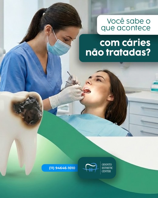 Você sabe o que acontece com cáries não tratadas?