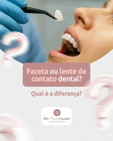 Faceta ou lente de contato dental? Qual é a diferença?
