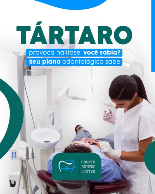 Tártaro provoca halitose, você sabia? Seu plano odontológico sabe