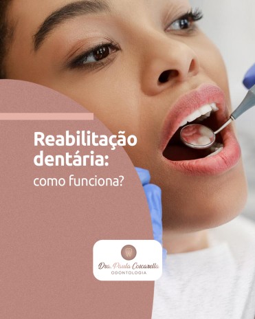 Reabilitação dentária: como funciona