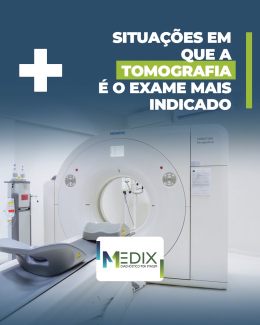 Situações em que a tomografia é o exame mais indicado