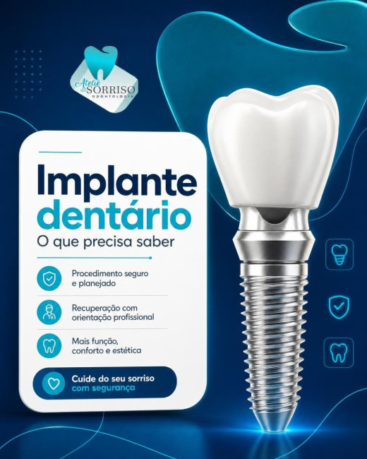 Implante Dentário: O que precisa saber