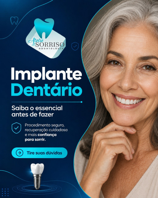 Implante Dentário: O que precisa saber